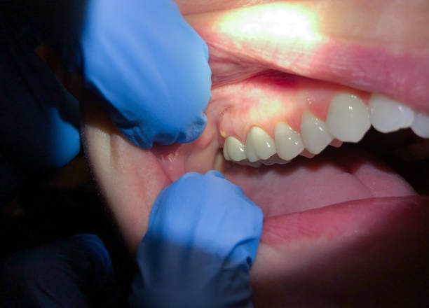 Best Mobile Emergency Dentist in Floresville, TX